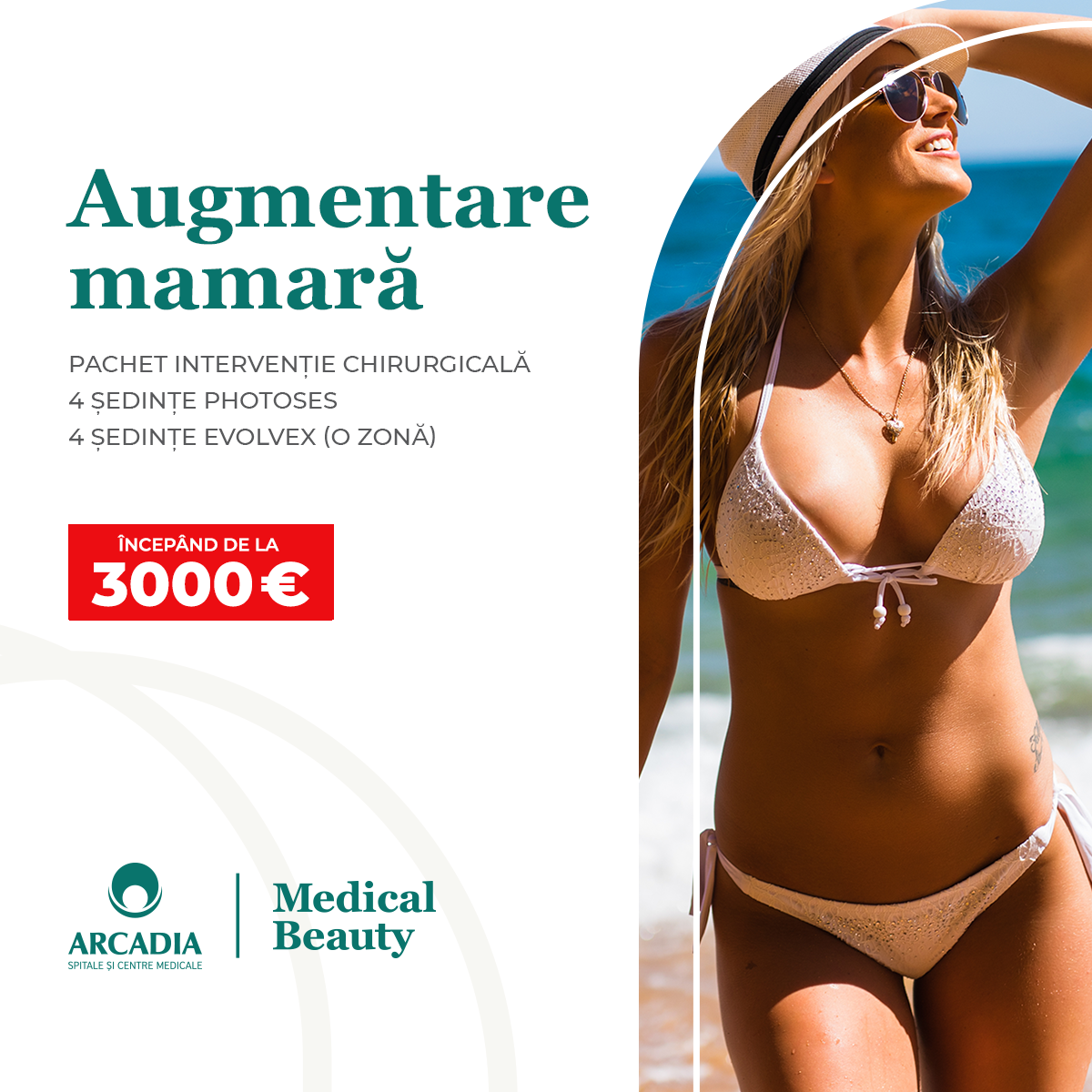 Augmentare mamară